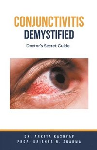 bokomslag Conjunctivitis Demystified