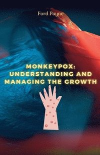 bokomslag Monkeypox