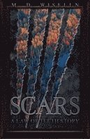 Scars