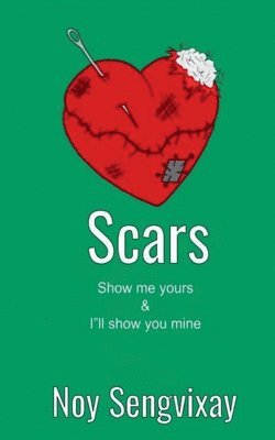Scars 1