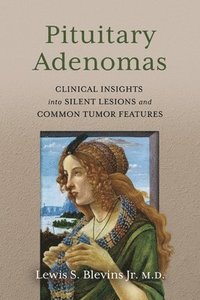 bokomslag Pituitary Adenomas: Clinical Insights Into Silent Lesions and Common Tumor Features