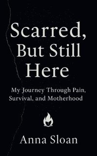 bokomslag Scarred, But Still Here: My Journey Through Pain, Survival, and Motherhood