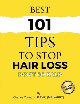 Charles Young - Best 101 Tips to Stop Hair Loss, Häftad
