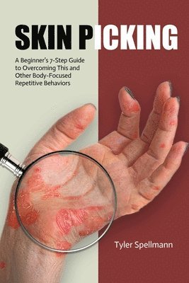 Skin Picking: A Beginner's 7-Step Guide to Overcoming This and Other Body-Focused Repetitive Behaviors 1