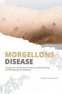 bokomslag Morgellons Disease: A Beginner's Quick Start Guide to Understanding and Managing the Condition
