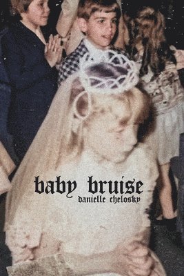 Baby Bruise