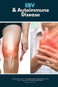 bokomslag EBV & Autoimmune Disease