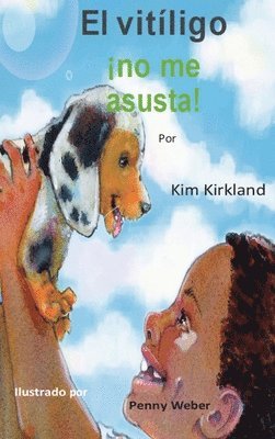 bokomslag vitiligo no me asusta