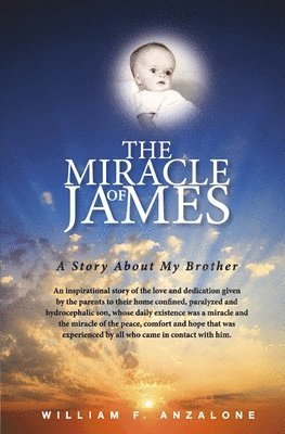 The Miracle of James 1