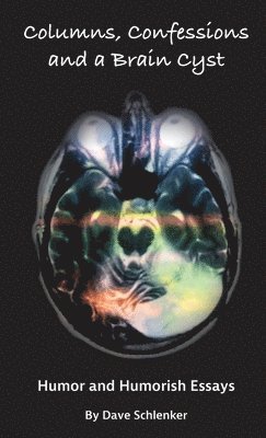 Dave T Schlenker, Dave T. Schlenker - Columns, Confessions and A Brain Cyst, Inbunden