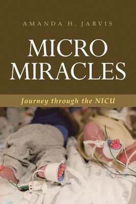 Micro Miracles 1