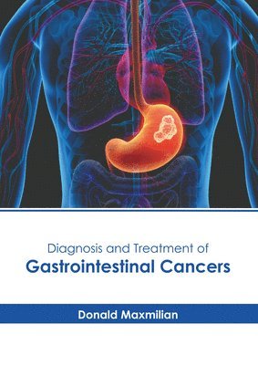 Donald Maxmilian - Diagnosis and Treatment of Gastrointestinal Cancers, Inbunden