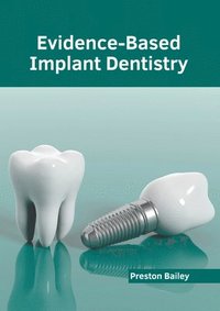 bokomslag Evidence-Based Implant Dentistry