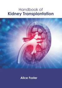 bokomslag Handbook of Kidney Transplantation