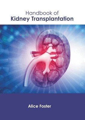 Handbook of Kidney Transplantation 1