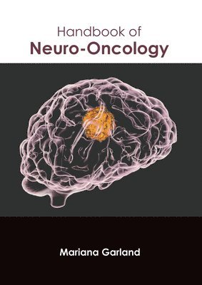 bokomslag Handbook of Neuro-Oncology