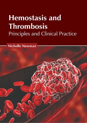 Hemostasis and Thrombosis: Principles and Clinical Practice 1
