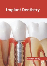 bokomslag Implant Dentistry