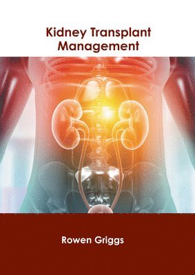 bokomslag Kidney Transplant Management