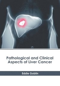 bokomslag Pathological and Clinical Aspects of Liver Cancer