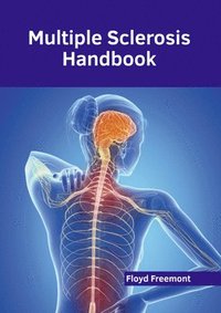 bokomslag Multiple Sclerosis Handbook