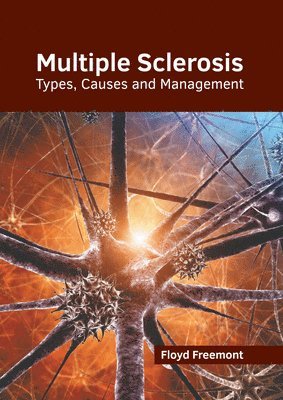 bokomslag Multiple Sclerosis: Types, Causes and Management