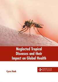 bokomslag Neglected Tropical Diseases and Their Impact on Global Health