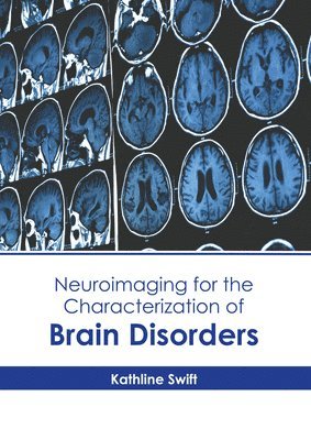 Neuroimaging for the Characterization of Brain Disorders 1