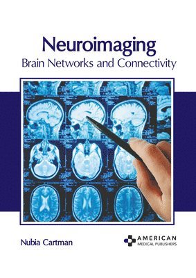 Neuroimaging: Brain Networks and Connectivity 1