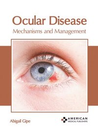bokomslag Ocular Disease: Mechanisms and Management