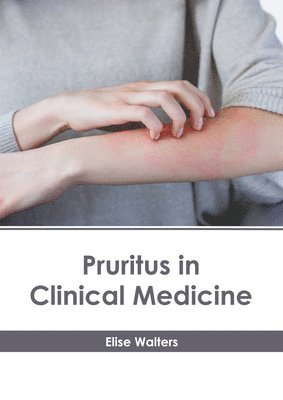 Elise Walters - Pruritus in Clinical Medicine, Inbunden