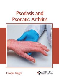 bokomslag Psoriasis and Psoriatic Arthritis