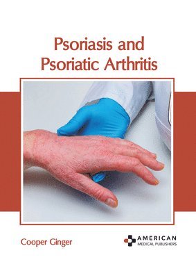 Psoriasis and Psoriatic Arthritis 1