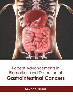 Recent Advancements in Biomarkers and Detection of Gastrointestinal Cancers 1