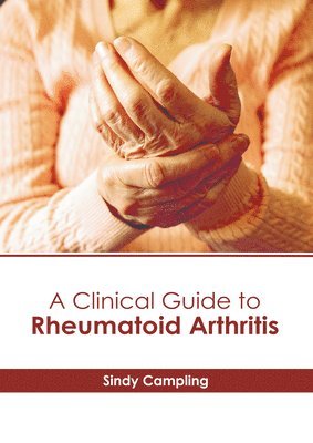 A Clinical Guide to Rheumatoid Arthritis 1