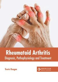 bokomslag Rheumatoid Arthritis: Diagnosis, Pathophysiology and Treatment