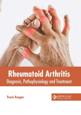 Rheumatoid Arthritis: Diagnosis, Pathophysiology and Treatment 1