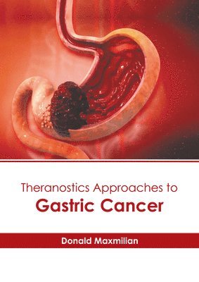 Theranostics Approaches to Gastric Cancer 1