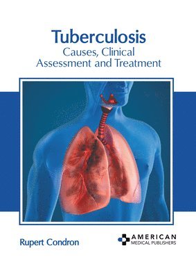 bokomslag Tuberculosis: Causes, Clinical Assessment and Treatment