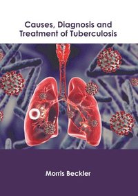 bokomslag Causes, Diagnosis and Treatment of Tuberculosis