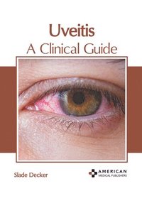 bokomslag Uveitis: A Clinical Guide