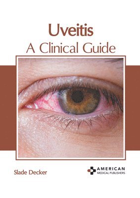 bokomslag Uveitis: A Clinical Guide