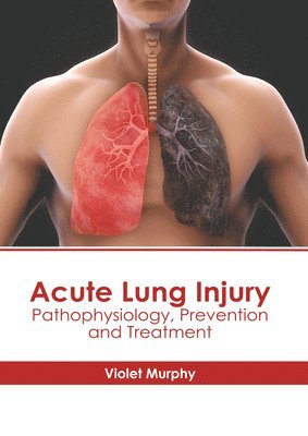 bokomslag Acute Lung Injury: Pathophysiology, Prevention and Treatment