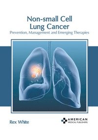 bokomslag Non-Small Cell Lung Cancer: Prevention, Management and Emerging Therapies