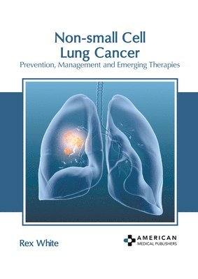 Non-Small Cell Lung Cancer: Prevention, Management and Emerging Therapies