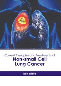 bokomslag Current Therapies and Treatments of Non-Small Cell Lung Cancer
