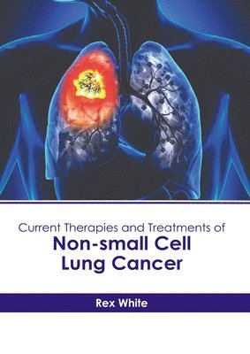 Current Therapies and Treatments of Non-Small Cell Lung Cancer 1
