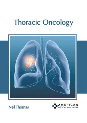 Neil Thomas - Thoracic Oncology, Inbunden