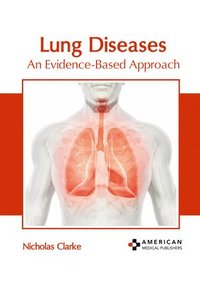 bokomslag Lung Diseases: An Evidence-Based Approach