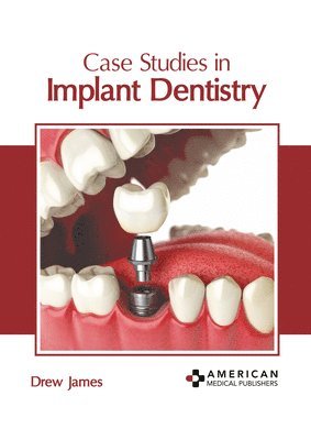 bokomslag Case Studies in Implant Dentistry